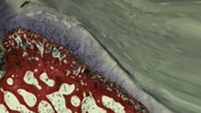 Healing healthy bone-tendon integration repair with ROTIUM®