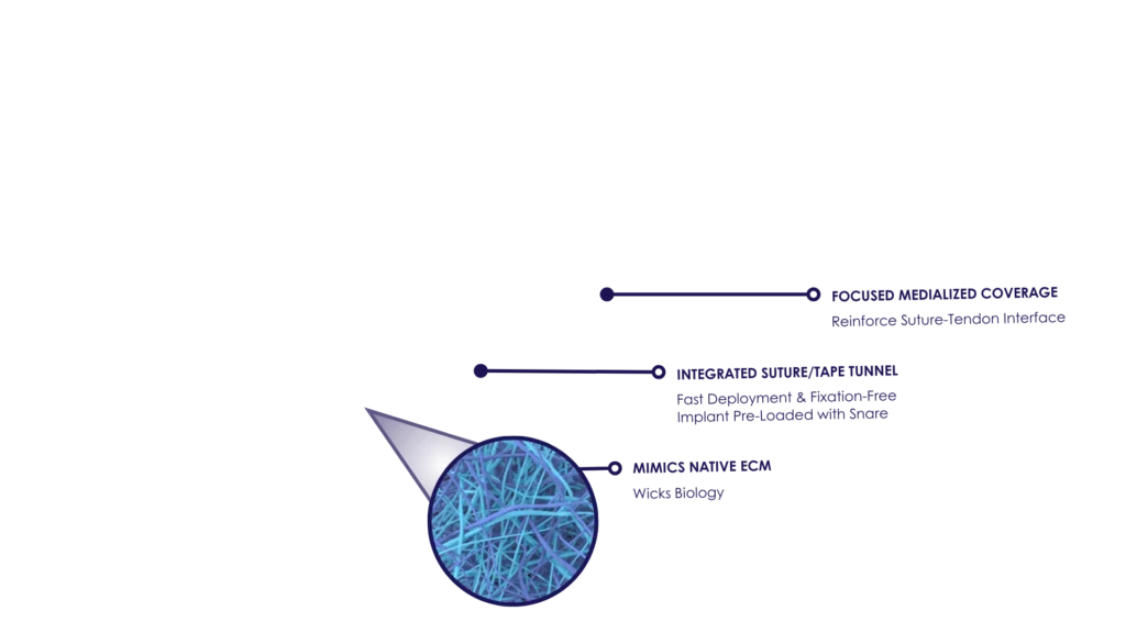 BioCharge® Features including: Focused medialized coverage, reinforce suture-tendon interface; integrated suture/tape tunnel, fast deployement and fixation-free implant pre-loaded with snare; mimics native ECM, wicks biology.