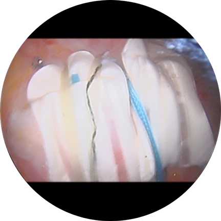 BioCharge® Scope image by Brian Badman, MD