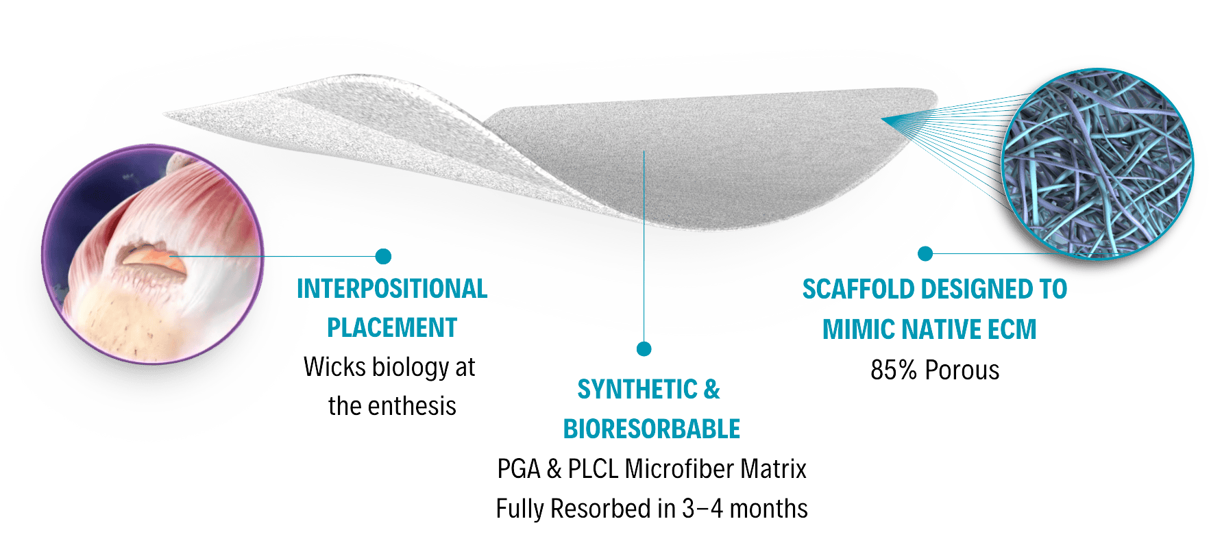 Rotium® Bioresorbable Wick features including: Interpositional placement; synthetic & bioresorbable; scaffold designed to mimic native ECM.
