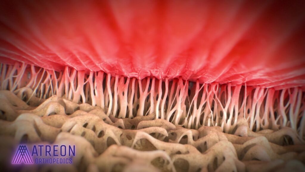 Tendon-bone interface at the enthesis, showing placement site for ROTIUM® scaffold to support biologic healing 