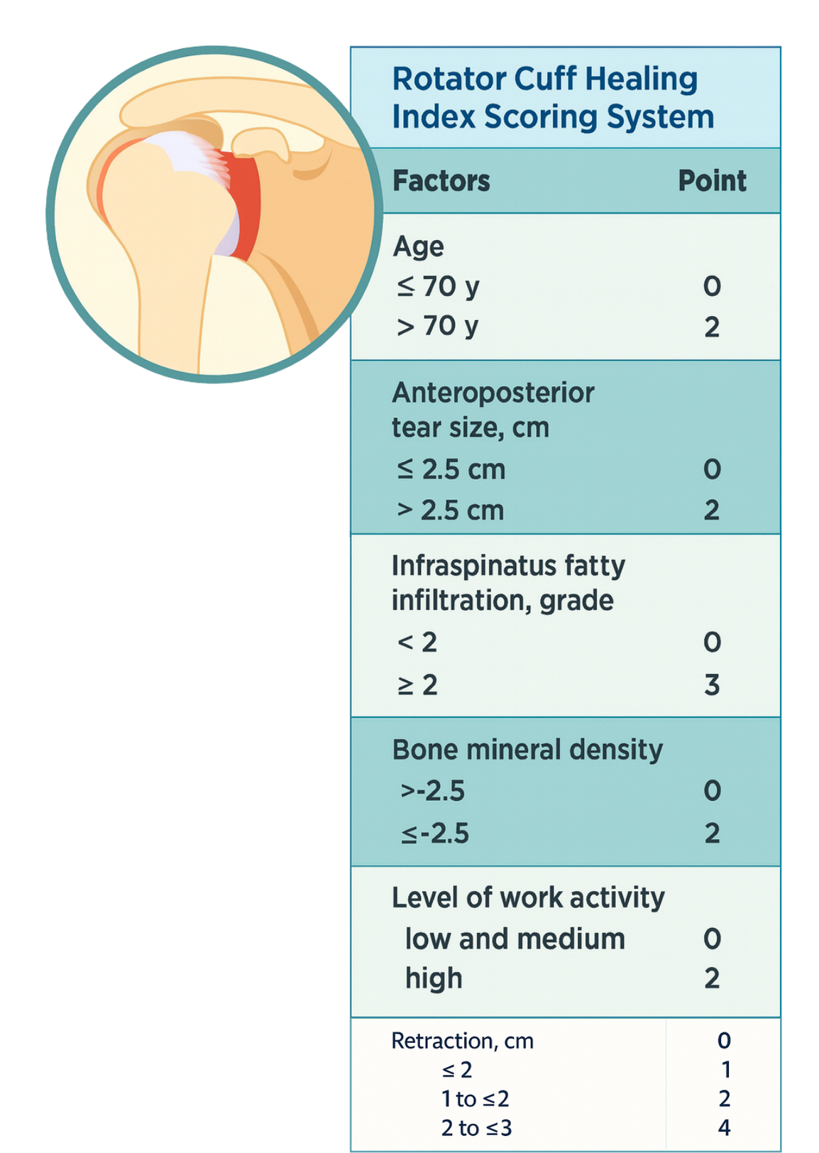 Rotator Cuff Healing Index (RoHI) score table with color-coded risk tiers showing variables and total scores to predict tendon healing after rotator cuff repair