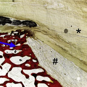 Rotator Cuff Repair Using a Bioresorbable Nanofiber Interposition Scaffold: A Biomechanical and Histologic Analysis in Sheep