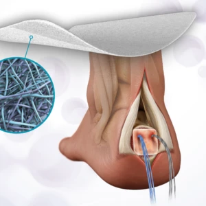 ROTIUM Foot & Ankle Brochure Thumbnail