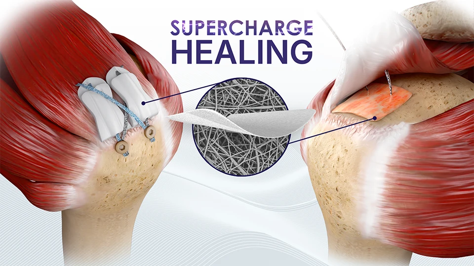 Atreon Home Page Header Mobile Supercharge Healing