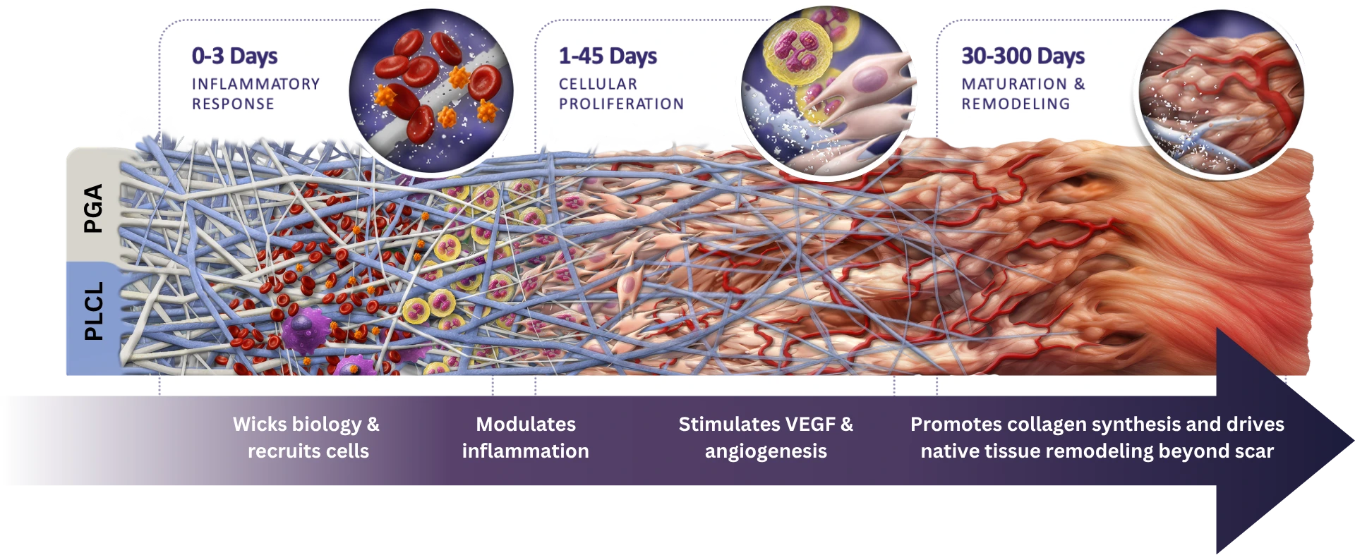Timeline-style medical illustration showing tissue regeneration across three healing phases. On the left, a layered scaffold labeled PGA above PLCL is densely woven with fibers and populated by blood cells and immune cells under the heading “0–3 Days Inflammatory Response.” In the middle, labeled “1–45 Days Cellular Proliferation,” cells infiltrate the scaffold as new tissue and blood vessels begin forming. On the right, labeled “30–300 Days Maturation & Remodeling,” the scaffold gives way to organized pink tissue with branching red blood vessels. A large arrow along the bottom summarizes the progression: wicks biology and recruits cells, modulates inflammation, stimulates VEGF and angiogenesis, and promotes collagen synthesis and native tissue remodeling beyond scar.