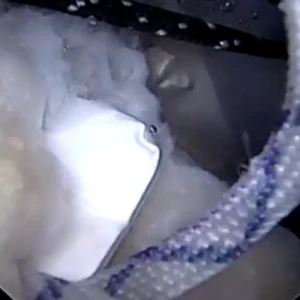 ROTIUM RCR - Dr. Dragomir Mijic Video Thumbnail