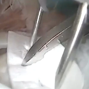 ROTIUM RCR - Dr. Jonathan Levy Video Thumbnail