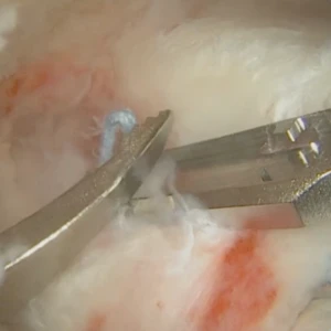 ROTIUM RCR - Dr. Shariff Bishai Video Thumbail