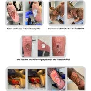 Lantis - Refractory Wounds Phoenix Poster Thumbnail