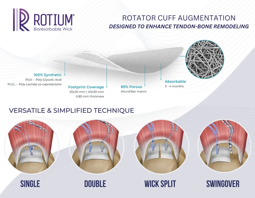 ROTIUM quick handout