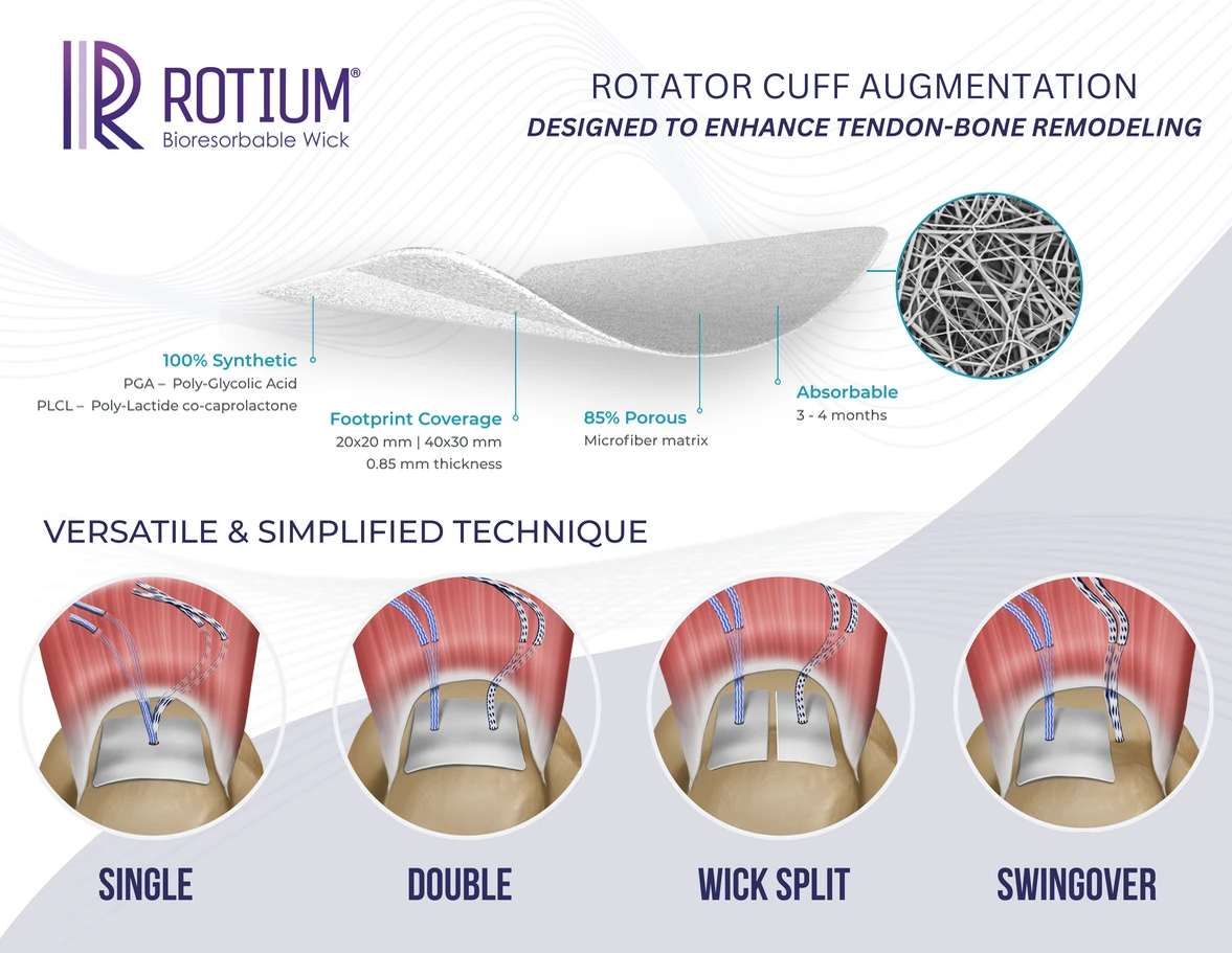ROTIUM quick handout