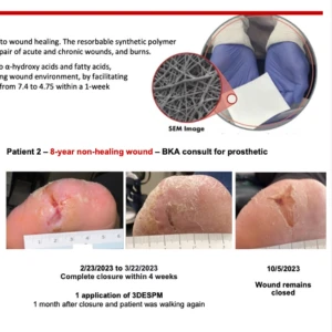 Tabchi - Complex Lower Extremity Phoenix Poster Thumbnail