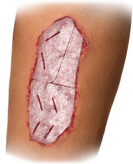 PHOENIX Leg Extended Application
